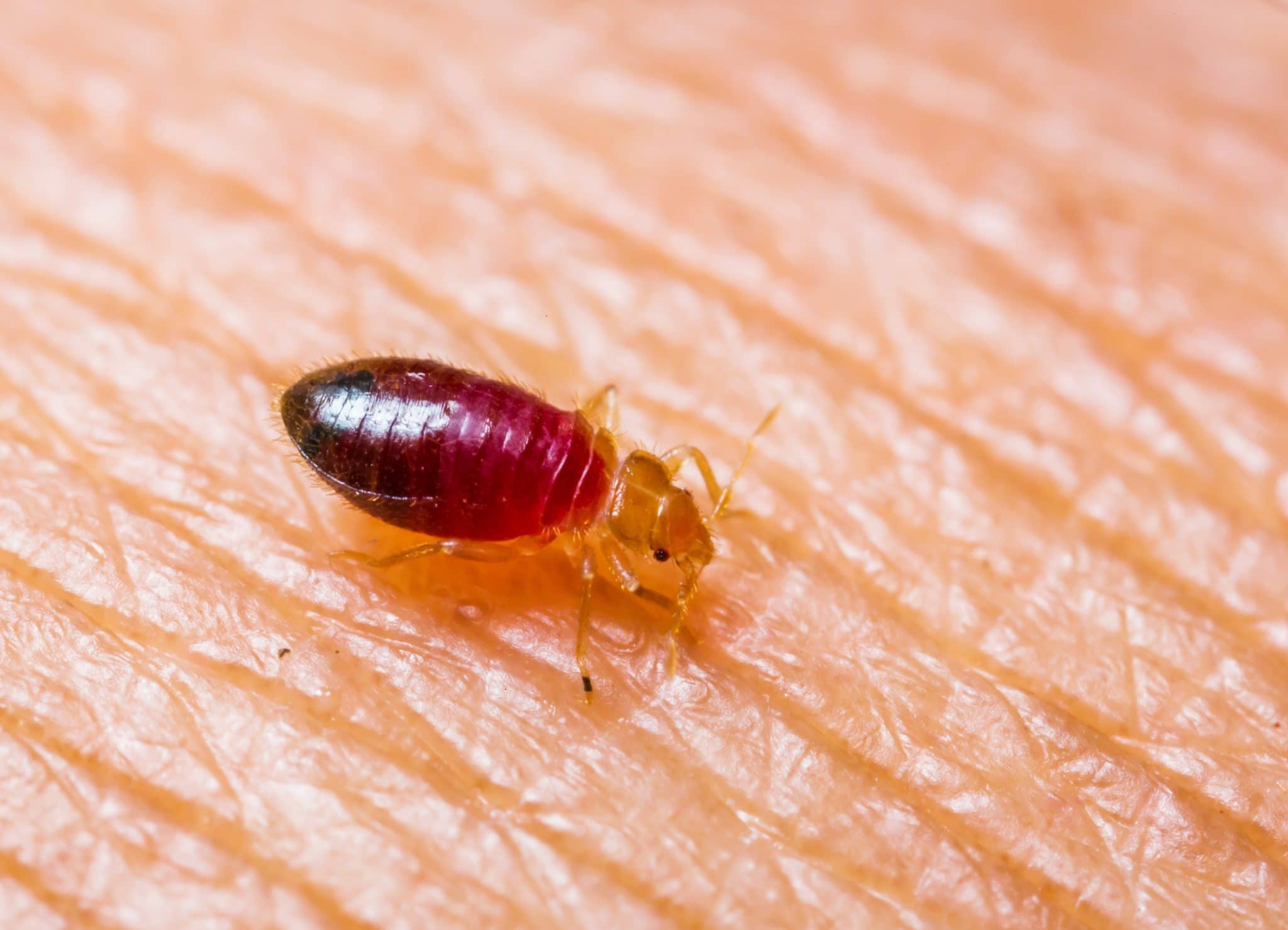 How to make bed bug bites go away , Natural bed bug spray FL , Spray to repel bed bugs , What can you put on bed bug bites , Bed bug bite spray Coral Springs , Relieve bed bug bites